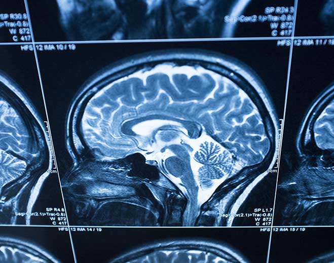 neurology-brain-scan-mri/